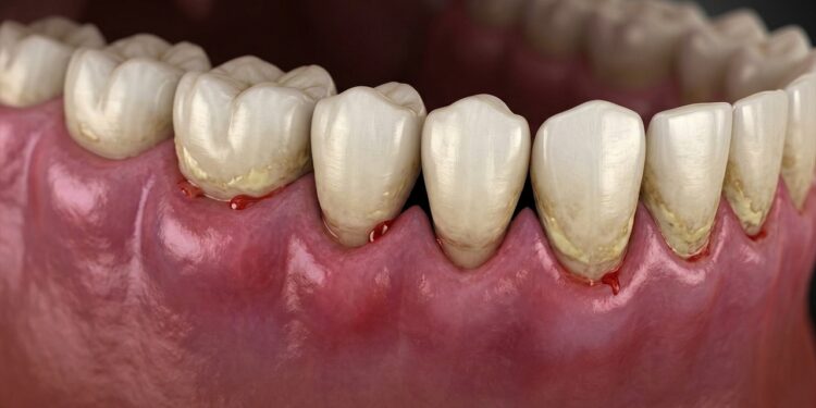 Problemas na gengiva podem indicar inflamação no coração, veja o que observar no dia a dia