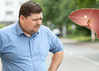 Você pode ter gordura no fígado? Veja como descobrir e o que evitar na sua dieta do dia a dia