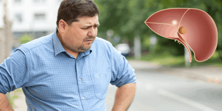 Você pode ter gordura no fígado? Veja como descobrir e o que evitar na sua dieta do dia a dia