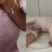 Cachorrinha fica com barriga inchada de repente e causa desespero na tutora