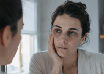 Palidez no rosto pode ser anemia? Sinais no espelho que merecem atenção