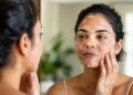 Vitiligo, por que as manchas brancas na pele aparecem? Veja o que a ciência já descobriu