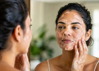 Vitiligo, por que as manchas brancas na pele aparecem? Veja o que a ciência já descobriu