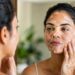 Vitiligo, por que as manchas brancas na pele aparecem? Veja o que a ciência já descobriu