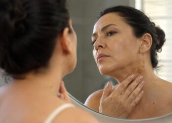 Sintomas de diabetes na pele: as manchas e sinais que podem aparecer antes do diagnóstico