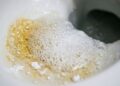 Como limpar o anel amarelo no fundo do vaso sanitário: veja como deixá-lo sem calcário e branco como no primeiro dia