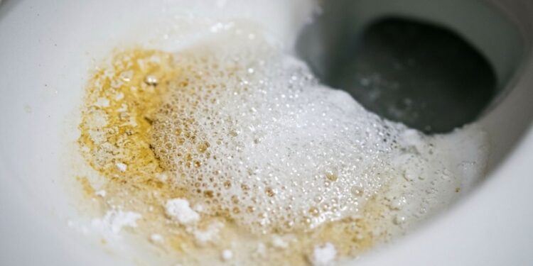 Como limpar o anel amarelo no fundo do vaso sanitário: veja como deixá-lo sem calcário e branco como no primeiro dia
