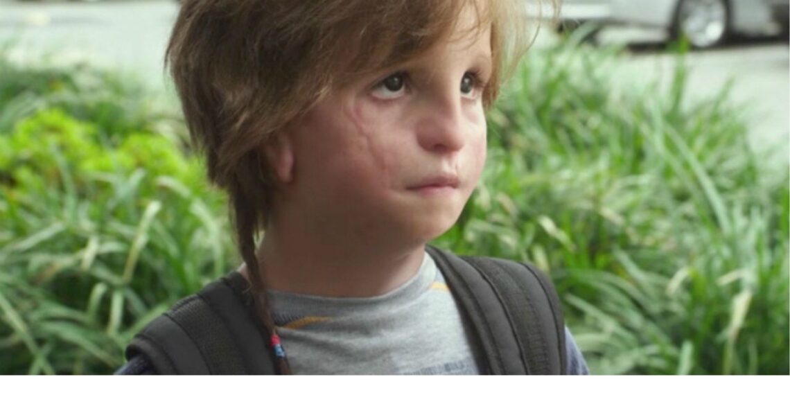 Esse filme aborda temas de empatia e aceitação te prometendo deixar emocionado do começo ao fim