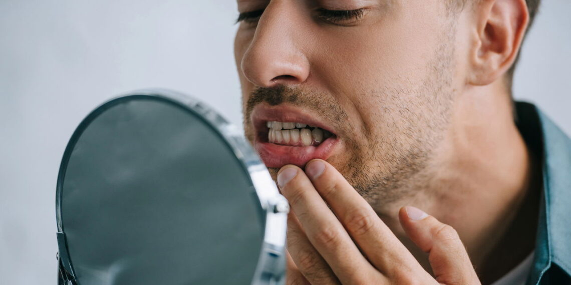 Sonhos com dentes caindo podem indicar algo muito importante
