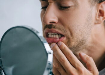 Sonhos com dentes caindo podem indicar algo muito importante