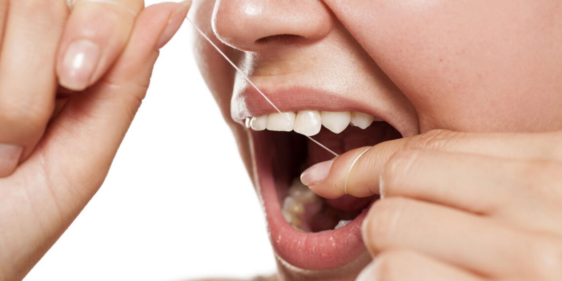 Por que a gengiva sangra às vezes ao passar o fio dental?