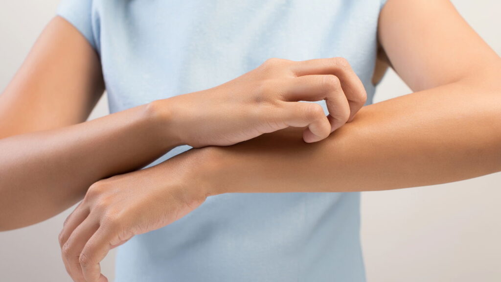 O melhores cuidados para dermatite no inverno começa no banho
