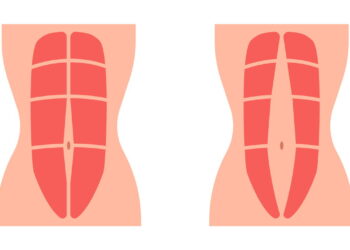 Abdominal de parede é fácil de fazer e ajuda a reduzir barriga rapidamente