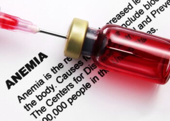 O sintoma mais ignorado da anemia pode estar atrapalhando seu dia a dia