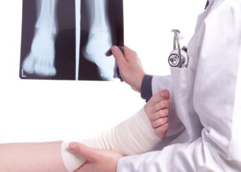 Por que milhões sofrem com entorse no tornozelo e poucos se recuperam bem