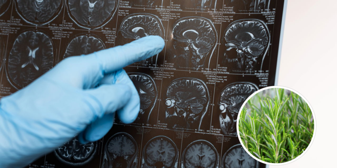Essa erva está associada a melhorar a memória, reduzir a ansiedade e proteção contra o Alzheimer