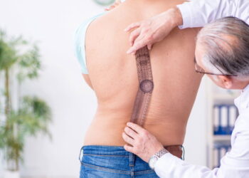 Escoliose leve pode ser controlada sem cirurgia com fisioterapia e hábitos saudáveis