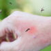 Adeus aos mosquitos: o truque caseiro para acabar com as picadas de uma vez por todas