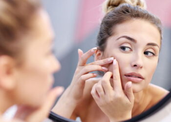 3 plantas que agem naturalmente no combate a acnes e espinhas