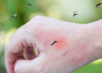 3 formas de usar essa erva para afastar mosquitos de vez
