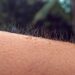 Por que sentimos arrepio quando ouvimos uma música e o que isso diz sobre nossas emoções