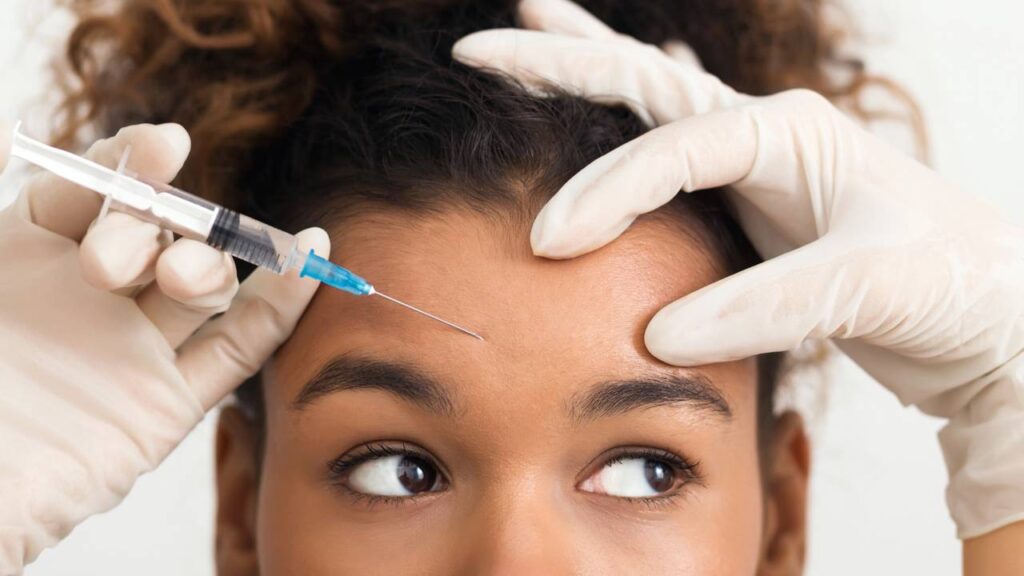 Botox aos 25? Saiba por que especialistas recomendam o procedimento tão cedo