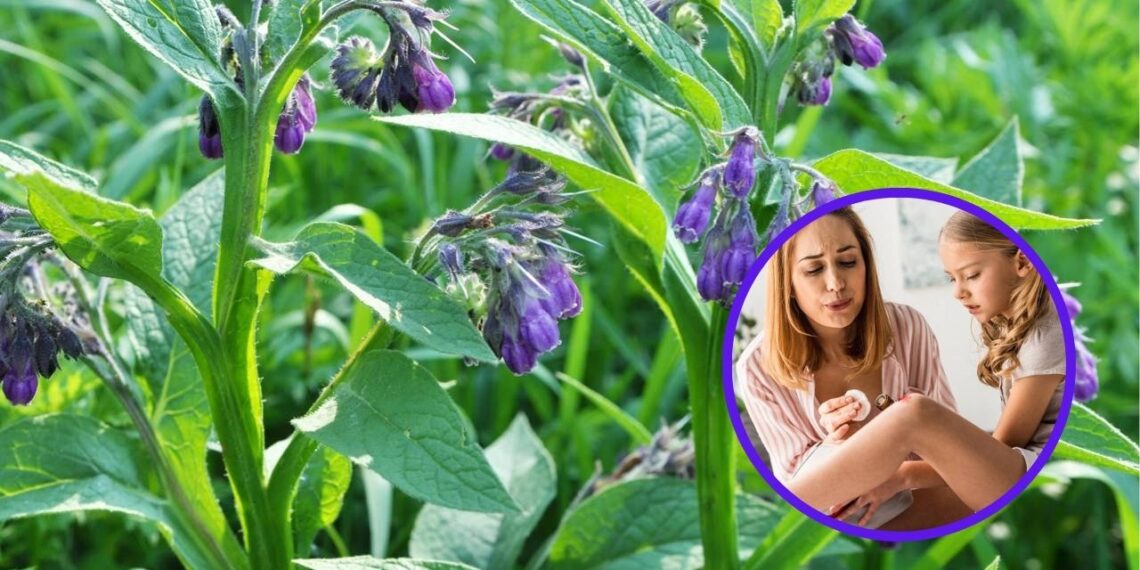 Confrei tem ação poderosa na cura de feridas e queimaduras