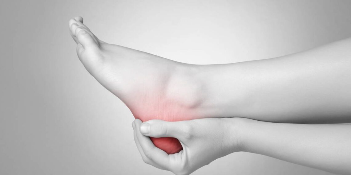 Quem sente dor no calcanhar precisa conhecer essas dicas fáceis para tratar a fascite plantar