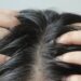 Como eliminar a oleosidade do cabelo em apenas 5 minutos
