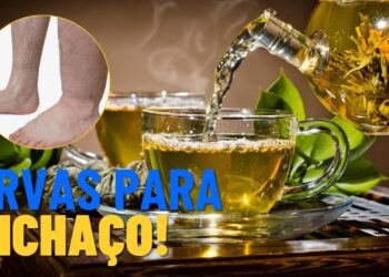 Ervas para diminuir o inchaço e aliviar a retenção de líquidos