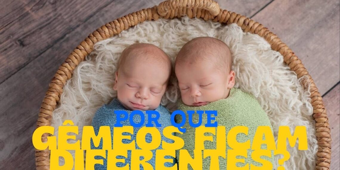Por que gêmeos idênticos ficam diferentes com o tempo, segundo especialista