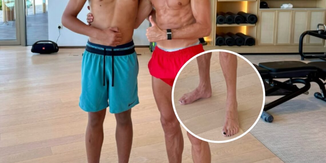Por que Cristiano Ronaldo pinta as unhas dos pés de preto? A explicação dos especialistas surpreende