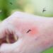 Preparando para o verão: como bloquear mosquitos com barreiras caseiras que duram