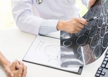 Os quatro hábitos de vida mais eficazes que previnem um AVC, segundo neurocirurgião