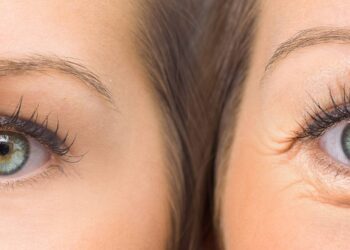 Como reduzir o inchaço dos olhos em casa com técnicas simples