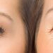 Como reduzir o inchaço dos olhos em casa com técnicas simples