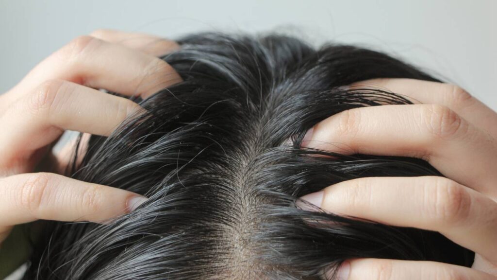 Dicas para diminuir a oleosidade do cabelo