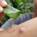 Poucas pessoas sabem disso, mas estas plantas aliviam coceira causada por picadas de insetos e reduzem a inflamação da pele