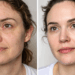 Como reduzir linhas de expressão de forma natural com hábitos simples do dia a dia