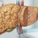 6 nutrientes essenciais para regenerar o fígado e os alimentos simples que você já tem em casa