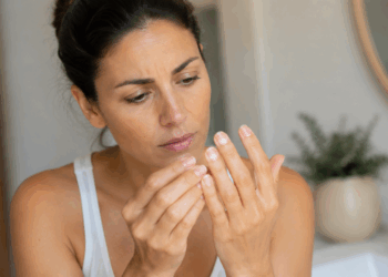 5 sinais nas suas unhas que podem indicar falta de zinco e outros minerais