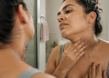 Nem sujeira, nem atrito: o que realmente causa manchas escuras nas axilas