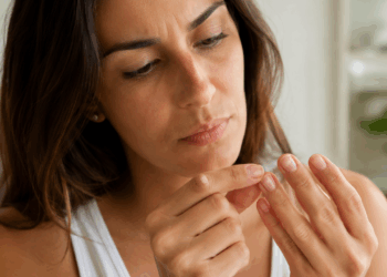 Nem sempre é falta de cálcio: o que as manchas nas unhas realmente podem revelar sobre sua saúde