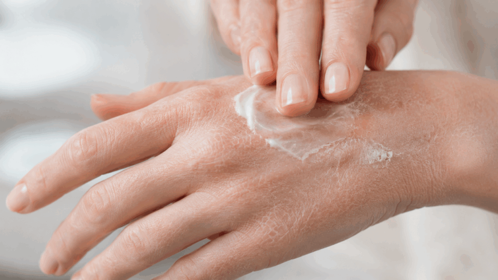 Nem creme caro, nem receita caseira: o que realmente ajuda a tratar suas mãos ressecadas