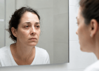 Olhos secos e fadiga intensa escondem problema autoimune, após os 40 anos que costumam confundir com estresse