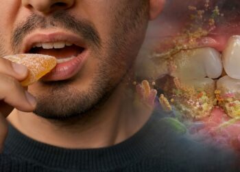 Nem apenas falta de escovação nem genética, a ciência explica o que realmente favorece a cárie dentária