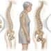 Nem só leite: os alimentos que ajudam a evitar osteoporose após os 50 chamam atenção dos médicos