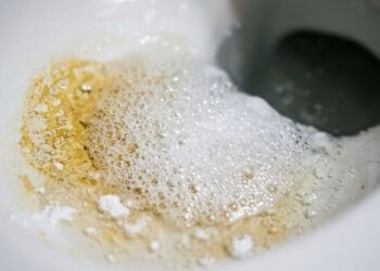 Como limpar o anel amarelo no fundo do vaso sanitário: veja como deixá-lo sem calcário e branco como no primeiro dia