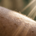 Tomar sol ajuda muito na saúde óssea, mas o benefício real para a síntese de vitamina D só aparece se a exposição diária for feita em áreas maiores do corpo, como braços e pernas, por pelo menos 15 minutos antes de aplicar o filtro solar