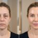 Como disfarçar as olheiras de cansaço: Dicas de massagem facial e autocuidado para o olhar.